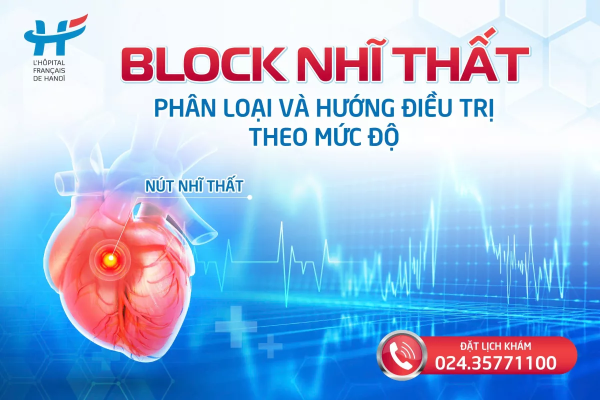 Block nhĩ thất: Phân loại và hướng điều trị theo mức độ